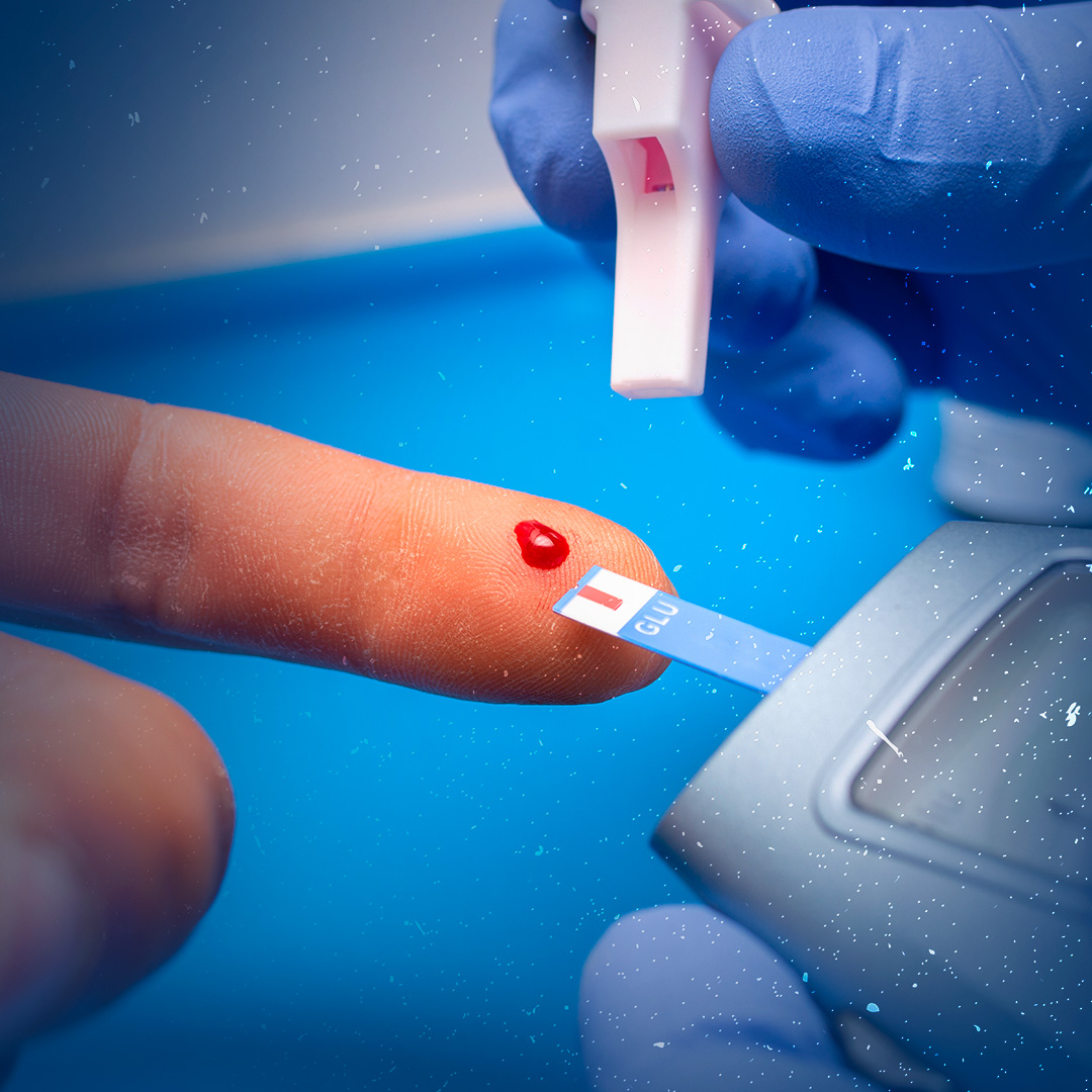 Sensor de glicemia é só tendência ou pode realmente ajudar a emagrecer?